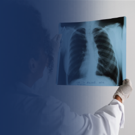 Chest X-ray