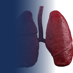 Acute cough multi component therapy